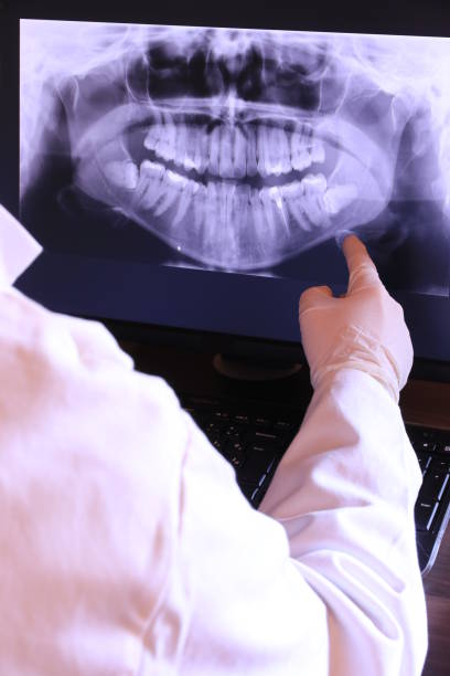 Best Emergency Broken Tooth Repair in Farngton, MI