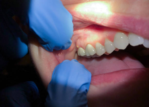 Best Pediatric Emergency Dentist in Farngton, MI