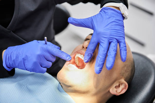 Best Emergency Root Canal Treatment in Farngton, MI